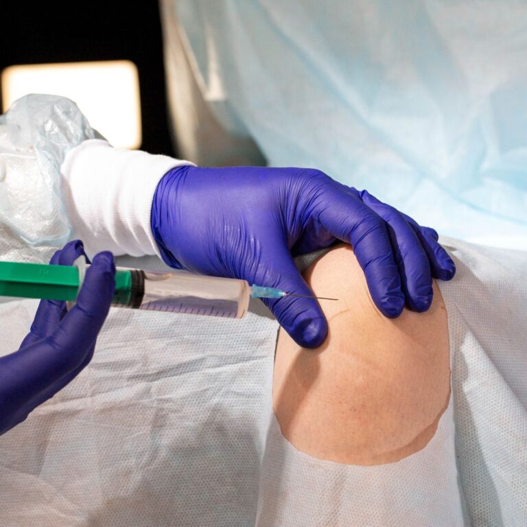 ACL Injuries and Sports-Related Knee Problems: Causes, Symptoms, and Treatment