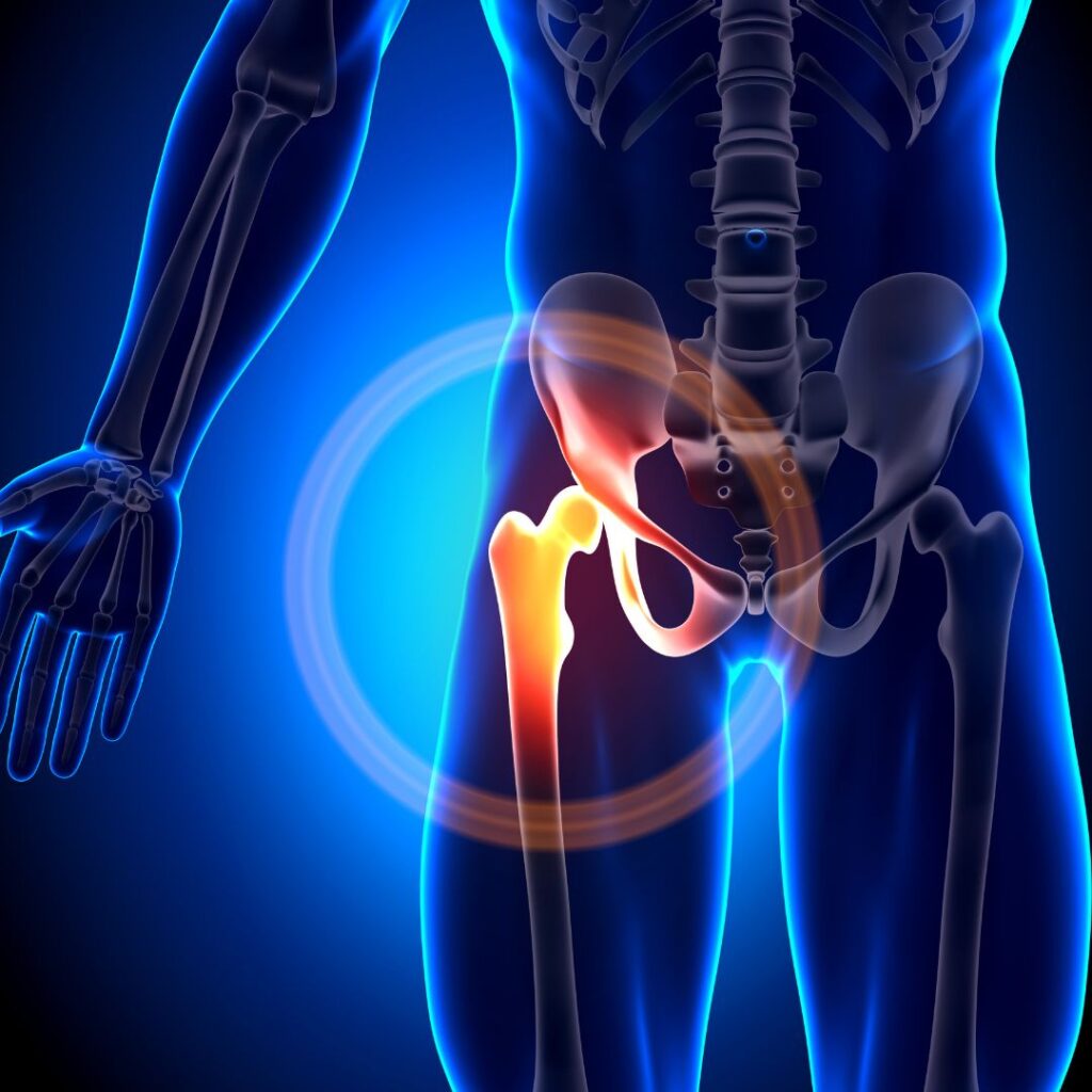 Hip Pain: Causes, Symptoms, Treatment Options, and Prevention Tips